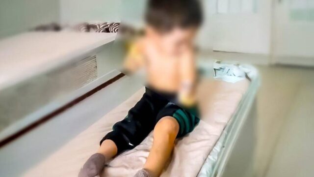 В Намангане четырехлетний ребенок лишился обеих рук из-за удара током