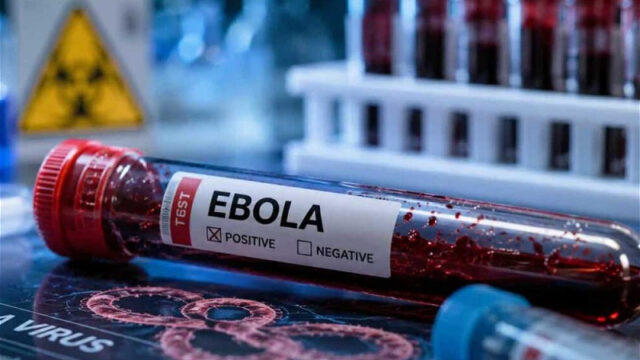 Во Франции зафиксирован первый случай заражения вирусом Эбола